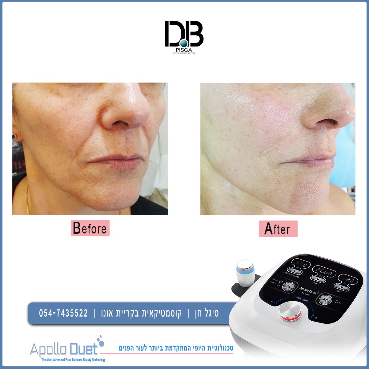 WhatsApp Image 2019-12-12 at 10.03.44