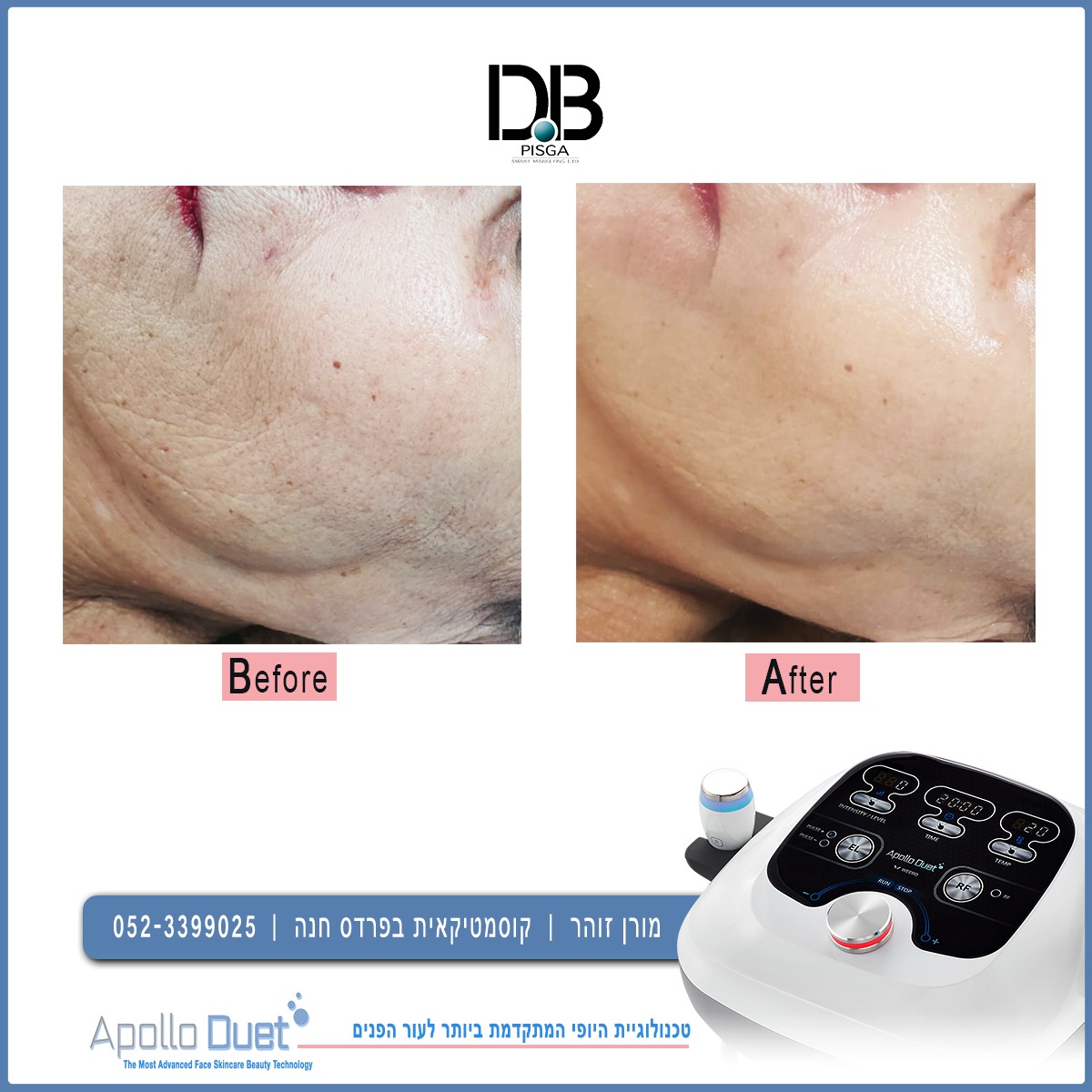 מורן זוהר גלי רדיו